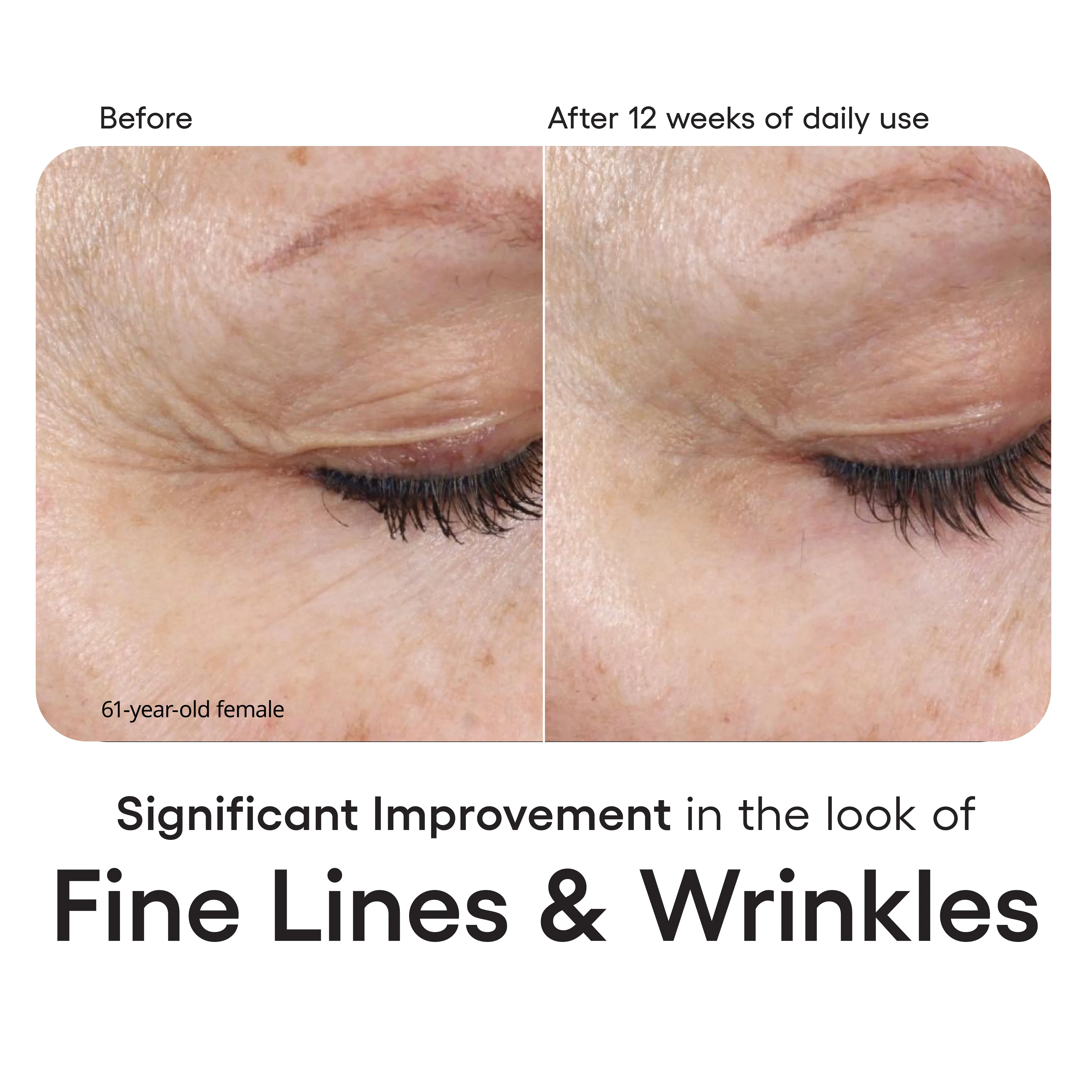 INTENSE  Serum Refill